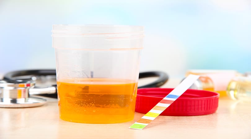 How Accurate Are Urine Drug Tests?
